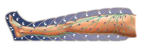 BTL-6000_Lymphastim_PIC_application_visualization-001.png